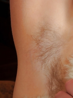 Artemisia Hairy Dutch Women